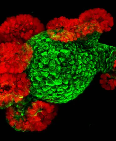 Organoids